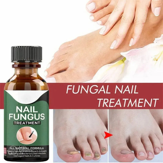 Nail Fungus Treatment Serum